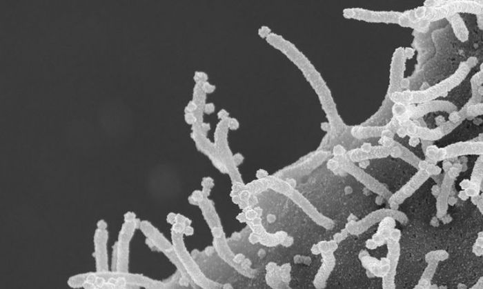 Las sorprendentes fotos de cómo ataca el coronavirus a las células humanas