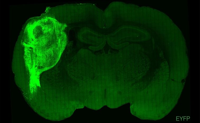 Insertan 'minicerebros' humanos en ratas y logran cambiar su comportamiento